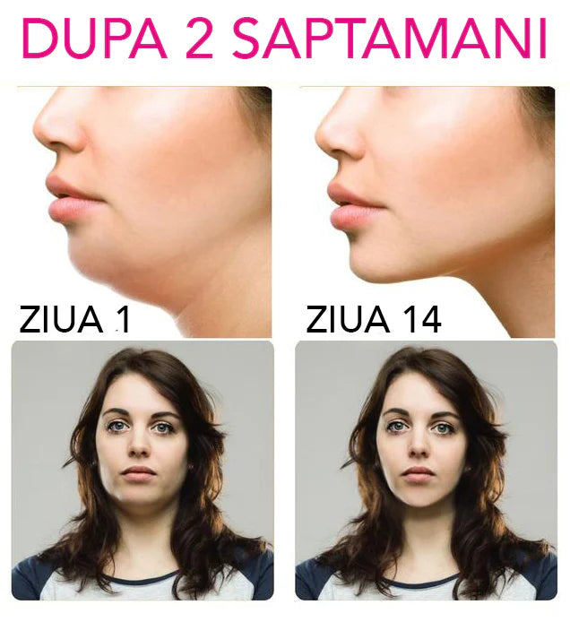 ContourLift V učvrstitvene maske