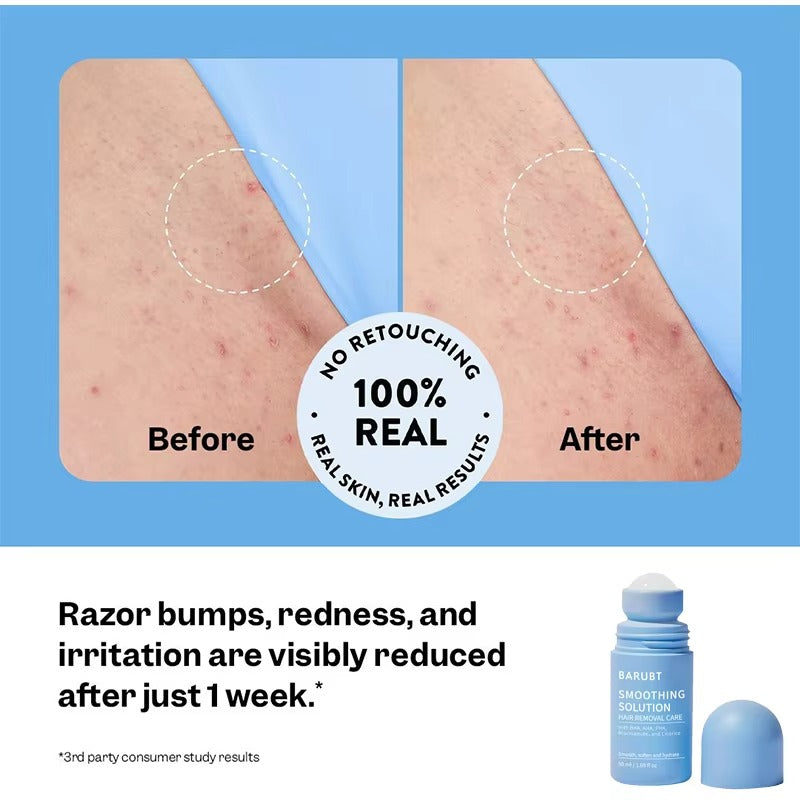 SkinCleanse™ pomirjujoči serum za draženje po britju
