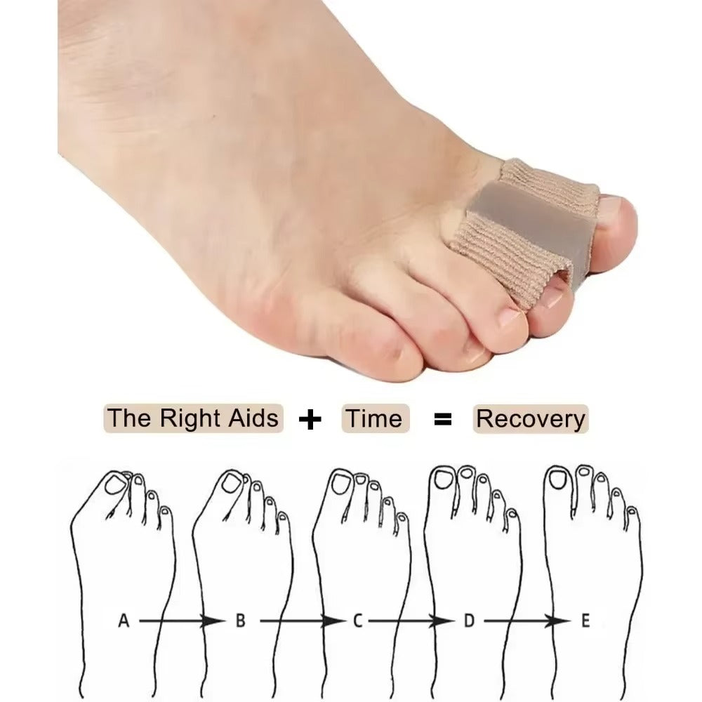 ComfortStride™ Poravnava prstov
