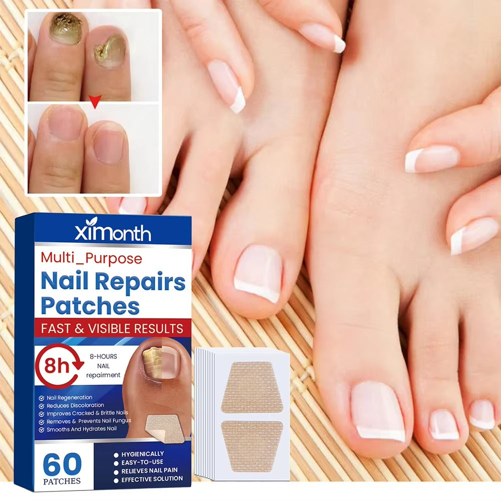 NailNurture™ nočni obnovitveni obliži proti glivicam na nohtih