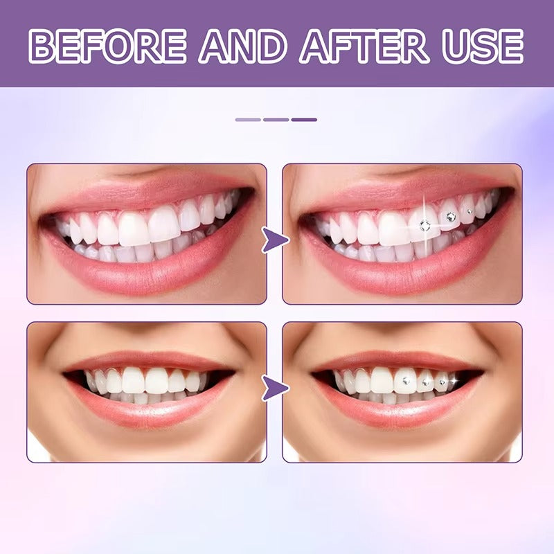 ToothGlam™ Zasij z vsakim nasmehom