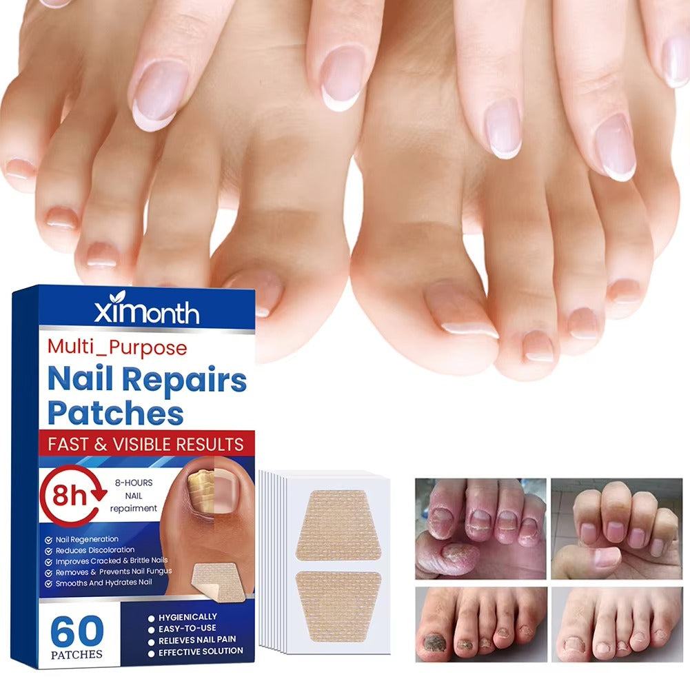 NailNurture™ nočni obnovitveni obliži proti glivicam na nohtih