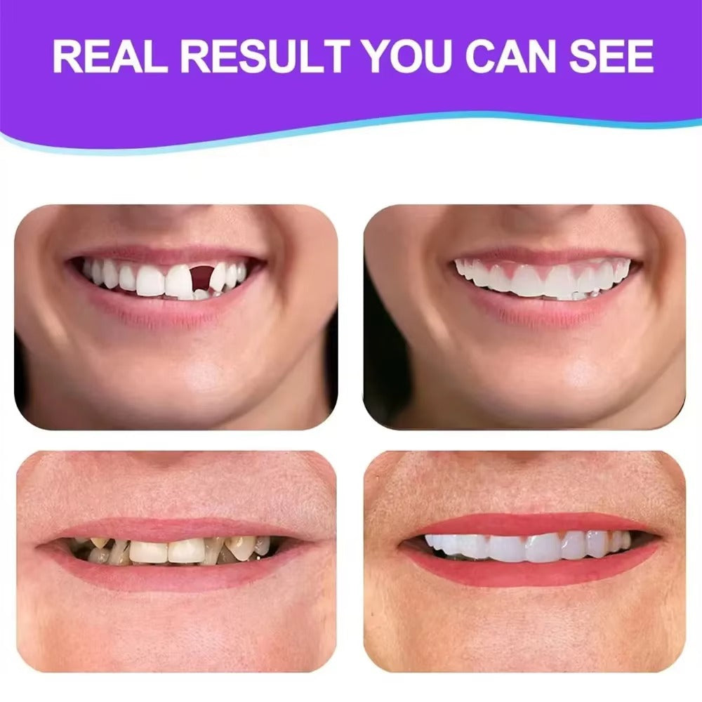 FlexiSmile™ komplet oblikovane zobne proteze