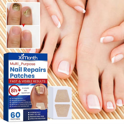 NailNurture™ nočni obnovitveni obliži proti glivicam na nohtih